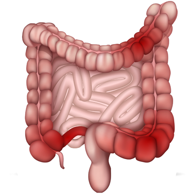 Lehrheftbild: Differenzialdiagnose