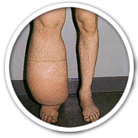 Lehrheftbild: Lymphe
